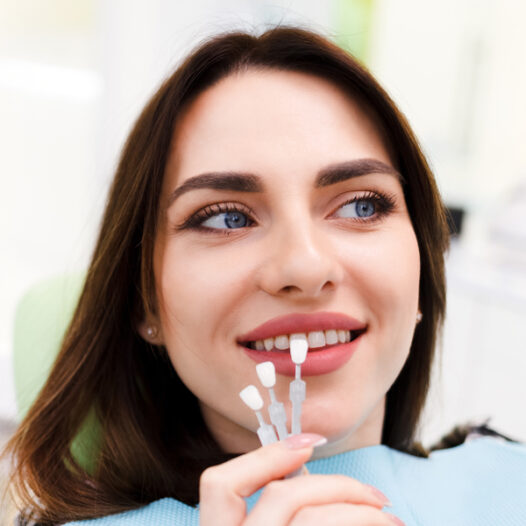 Five Facts About Dental Veneers
