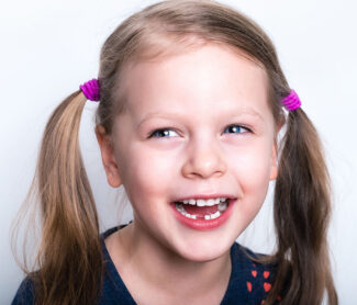 Why Do Children Need Dental Sealants?