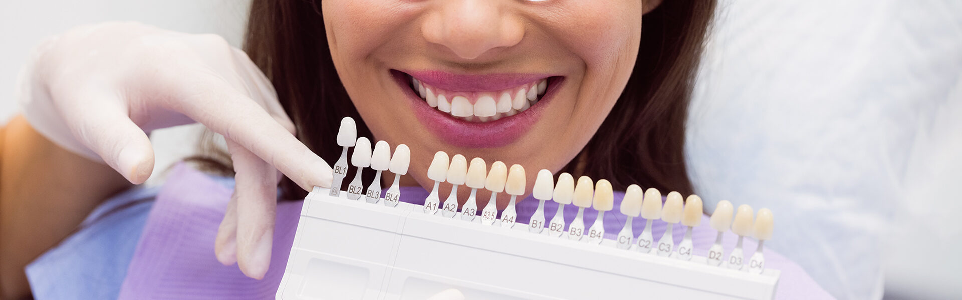 Is a Perfect Smile Possible? Exploring the Benefits of Dental Veneers
