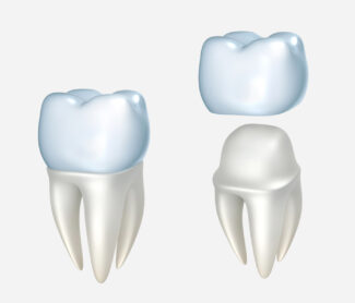Can Your Mouth Reject a Crown?