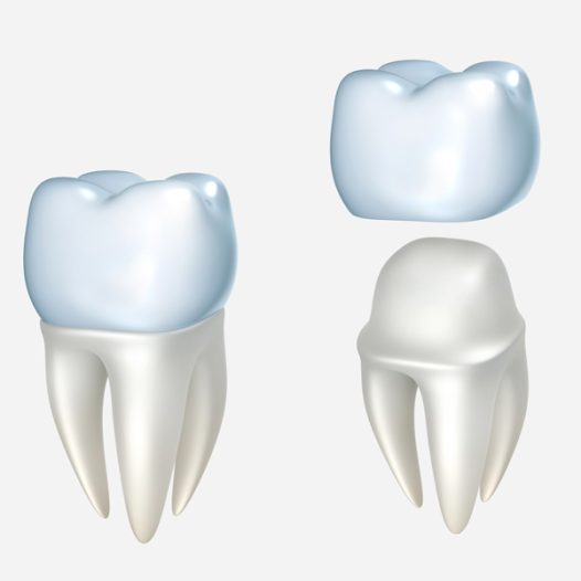 Can Your Mouth Reject a Crown?