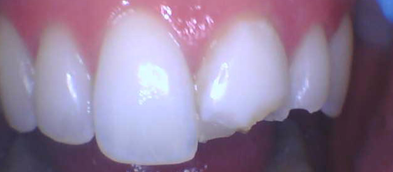Before