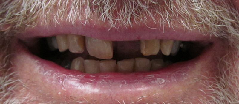 Before