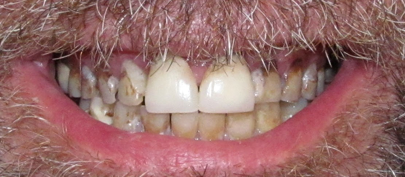 before dental treatment