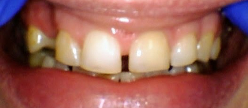 before dental treatment