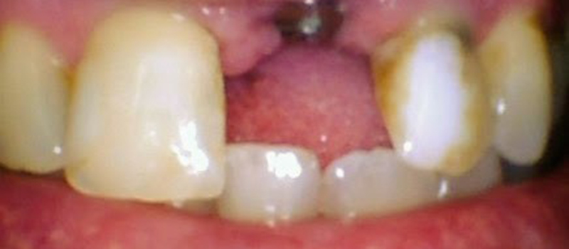 before dental treatment