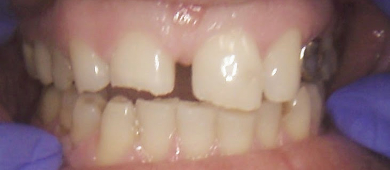 before dental treatment