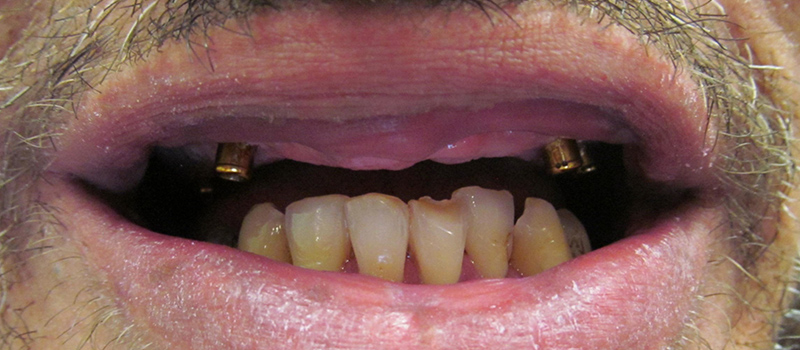before dental treatment